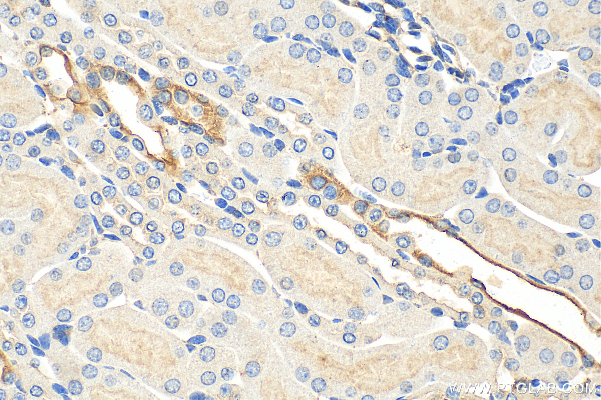 Immunohistochemistry (IHC) staining of mouse kidney tissue using AQP5 Polyclonal antibody (20334-1-AP)