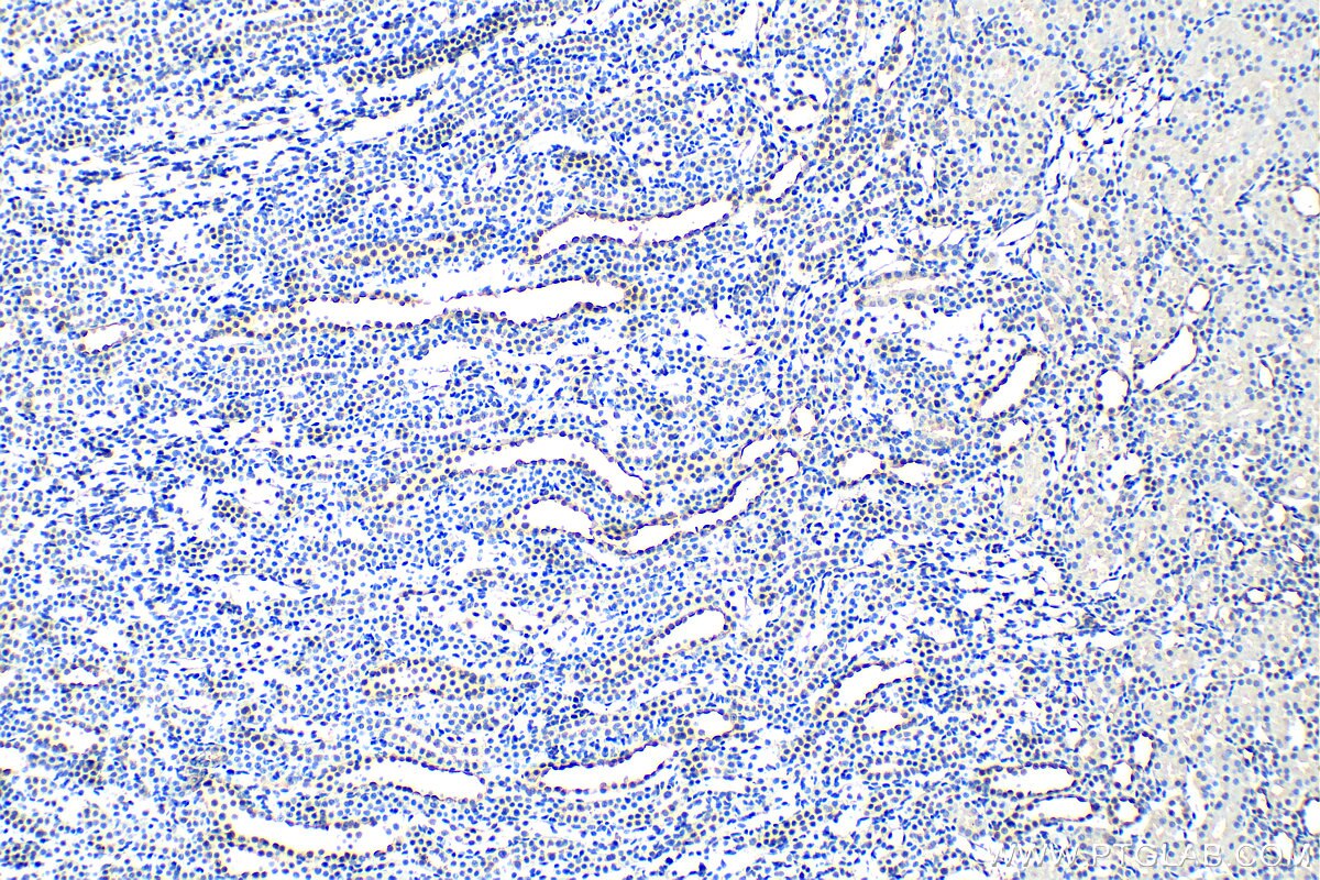 IHC staining of rat kidney using 20334-1-AP