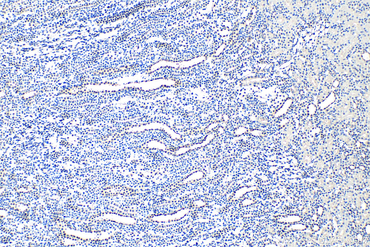 Immunohistochemistry (IHC) staining of rat kidney tissue using AQP5 Polyclonal antibody (20334-1-AP)