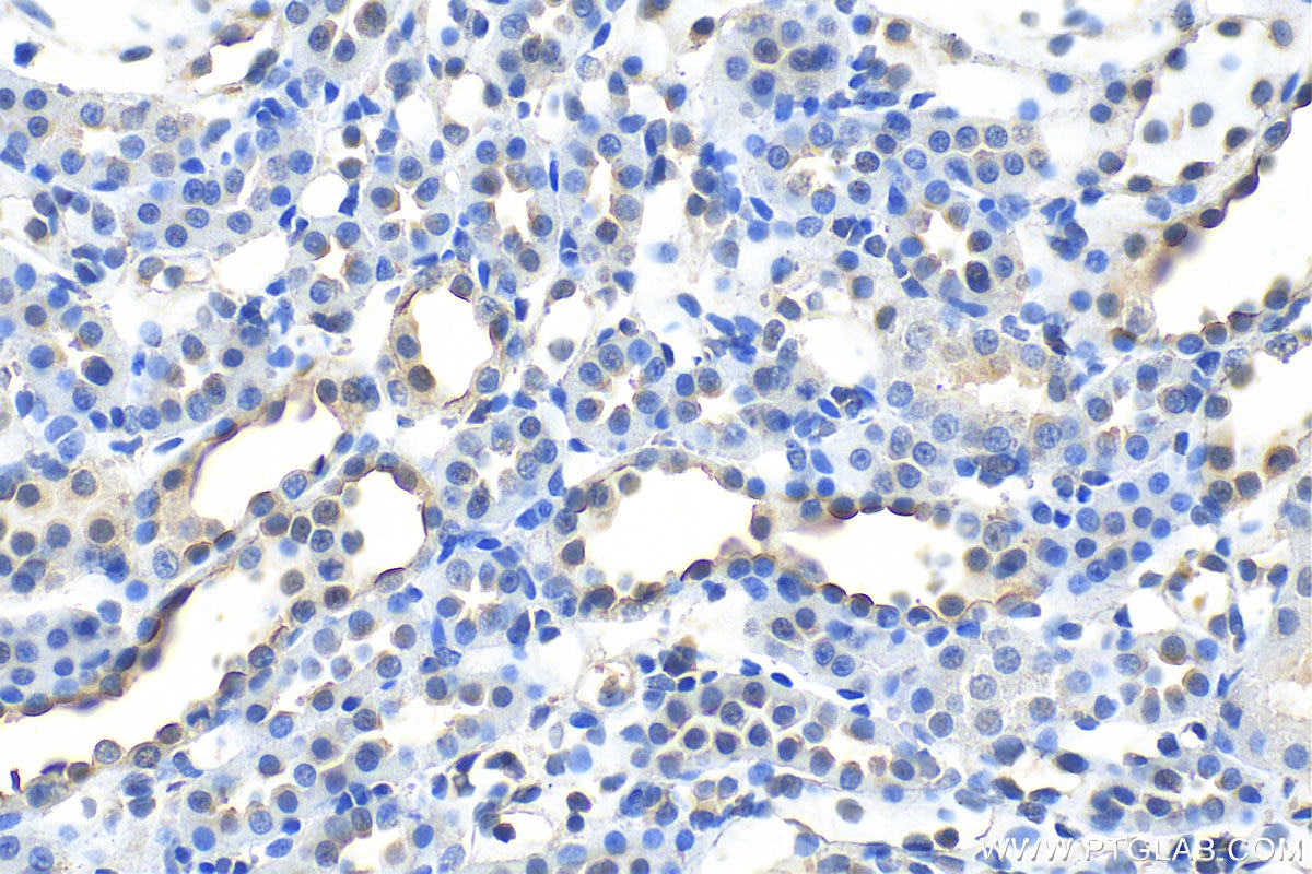 Immunohistochemistry (IHC) staining of rat kidney tissue using AQP5 Polyclonal antibody (20334-1-AP)