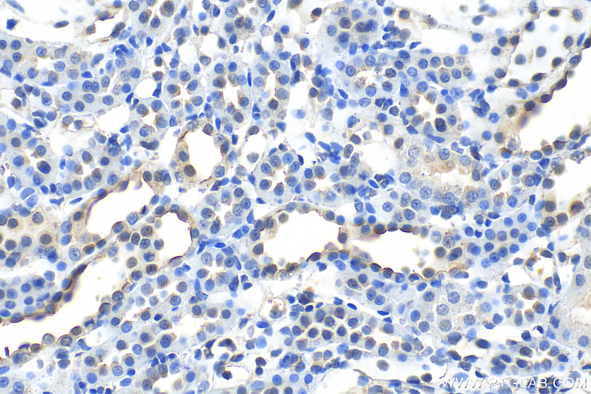 IHC staining of rat kidney using 20334-1-AP