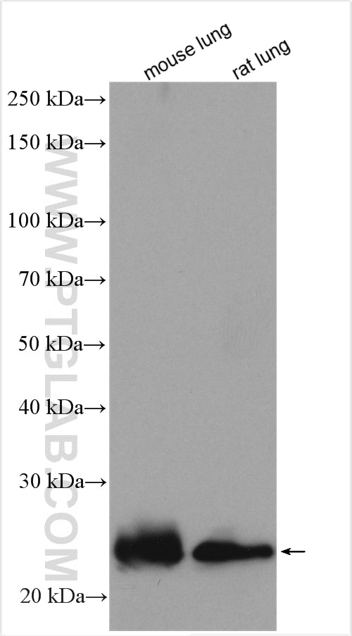 Western Blot (WB) analysis of various lysates using AQP5 Polyclonal antibody (20334-1-AP)