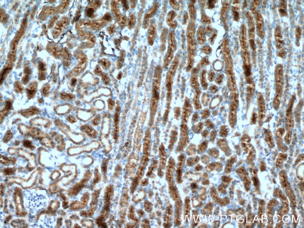 Immunohistochemistry (IHC) staining of mouse kidney tissue using AQP7 Polyclonal antibody (25131-1-AP)