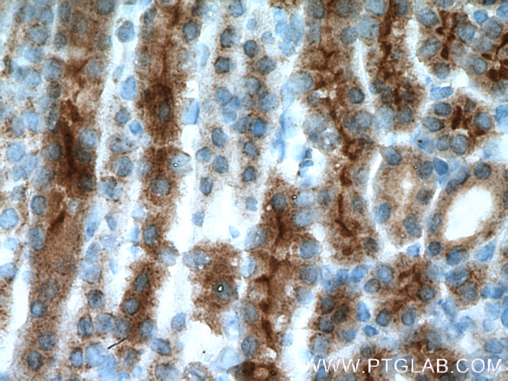 IHC staining of mouse kidney using 25131-1-AP