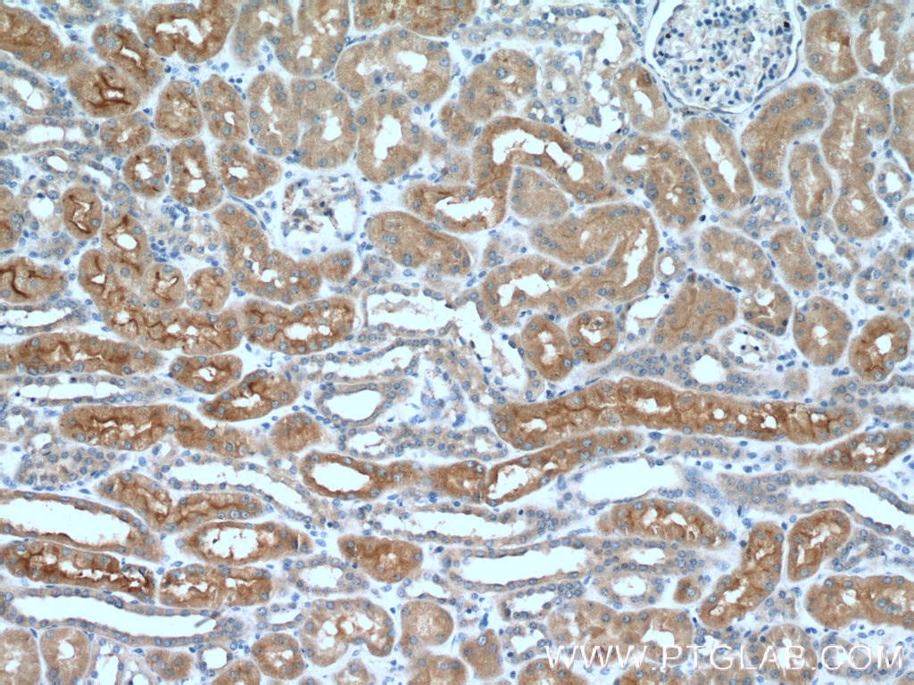 Immunohistochemistry (IHC) staining of human kidney tissue using AQP7 Polyclonal antibody (25131-1-AP)