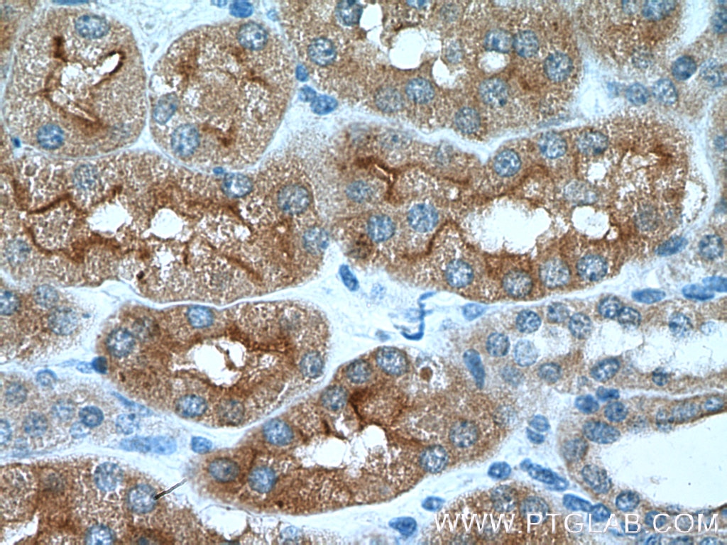 Immunohistochemistry (IHC) staining of human kidney tissue using AQP7 Polyclonal antibody (25131-1-AP)