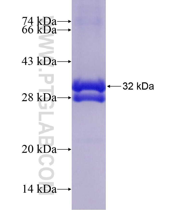 AQP7 fusion protein Ag17945 SDS-PAGE