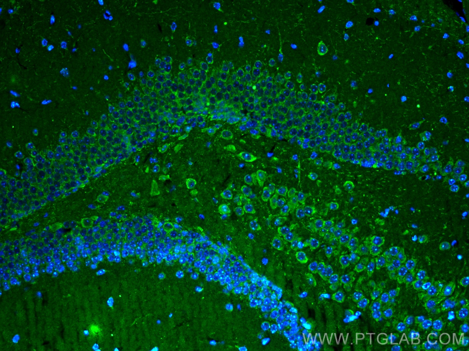 Immunofluorescence (IF) / fluorescent staining of mouse brain tissue using AQP9 Polyclonal antibody (20380-1-AP)