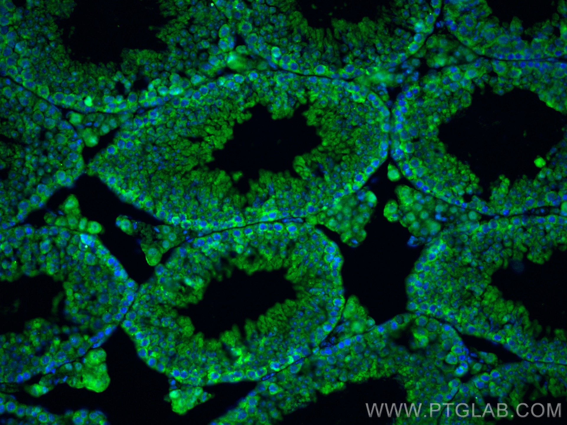 Immunofluorescence (IF) / fluorescent staining of mouse testis tissue using AQP9 Polyclonal antibody (20380-1-AP)