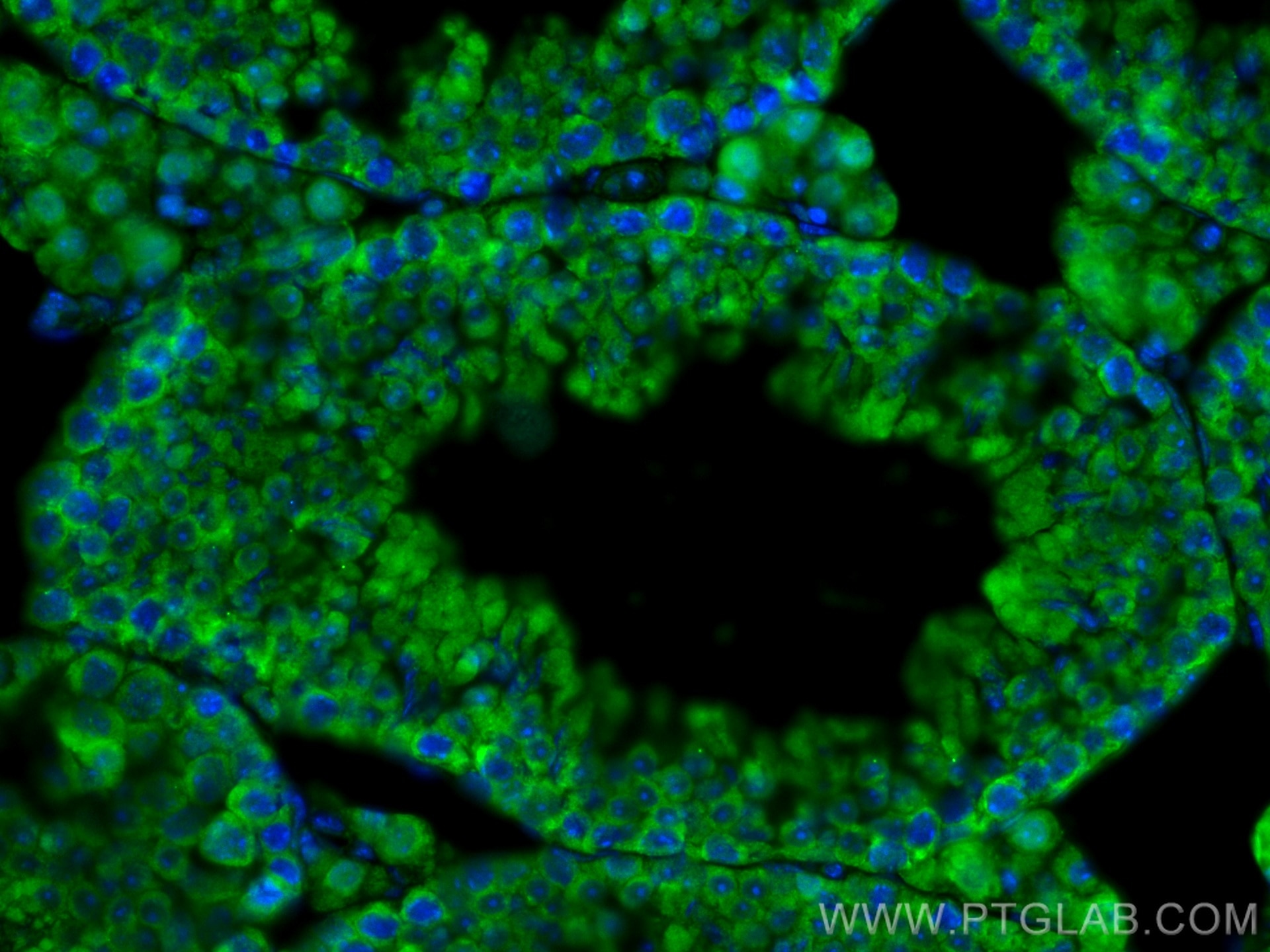 Immunofluorescence (IF) / fluorescent staining of mouse testis tissue using AQP9 Polyclonal antibody (20380-1-AP)