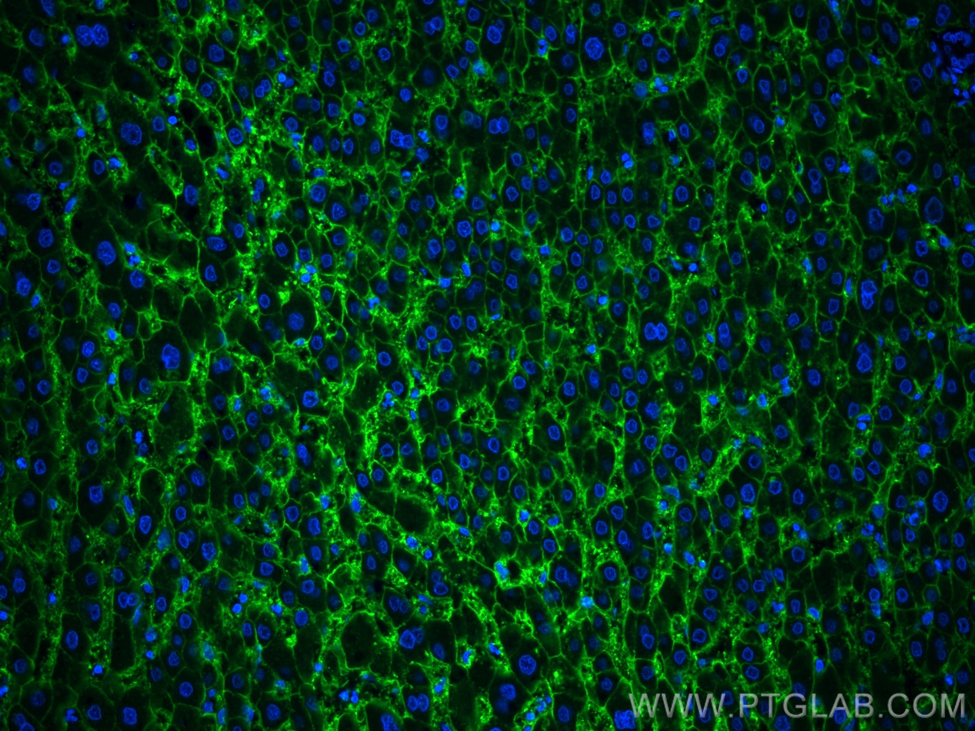Immunofluorescence (IF) / fluorescent staining of human liver tissue using AQP9 Polyclonal antibody (20380-1-AP)