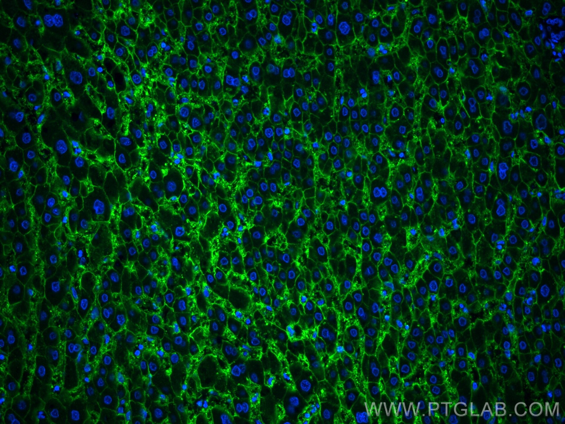 IF Staining of human liver using 20380-1-AP