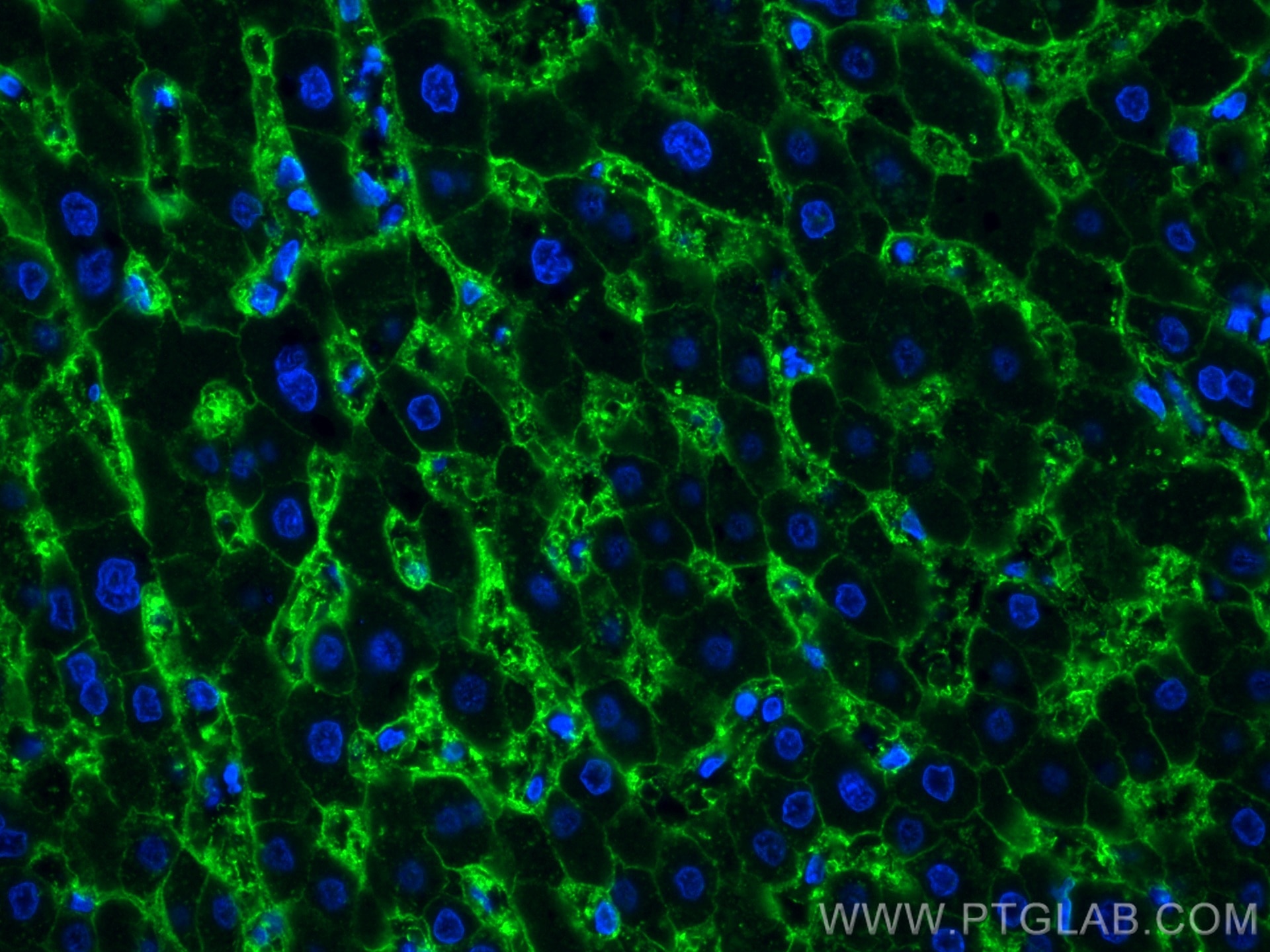 Immunofluorescence (IF) / fluorescent staining of human liver tissue using AQP9 Polyclonal antibody (20380-1-AP)