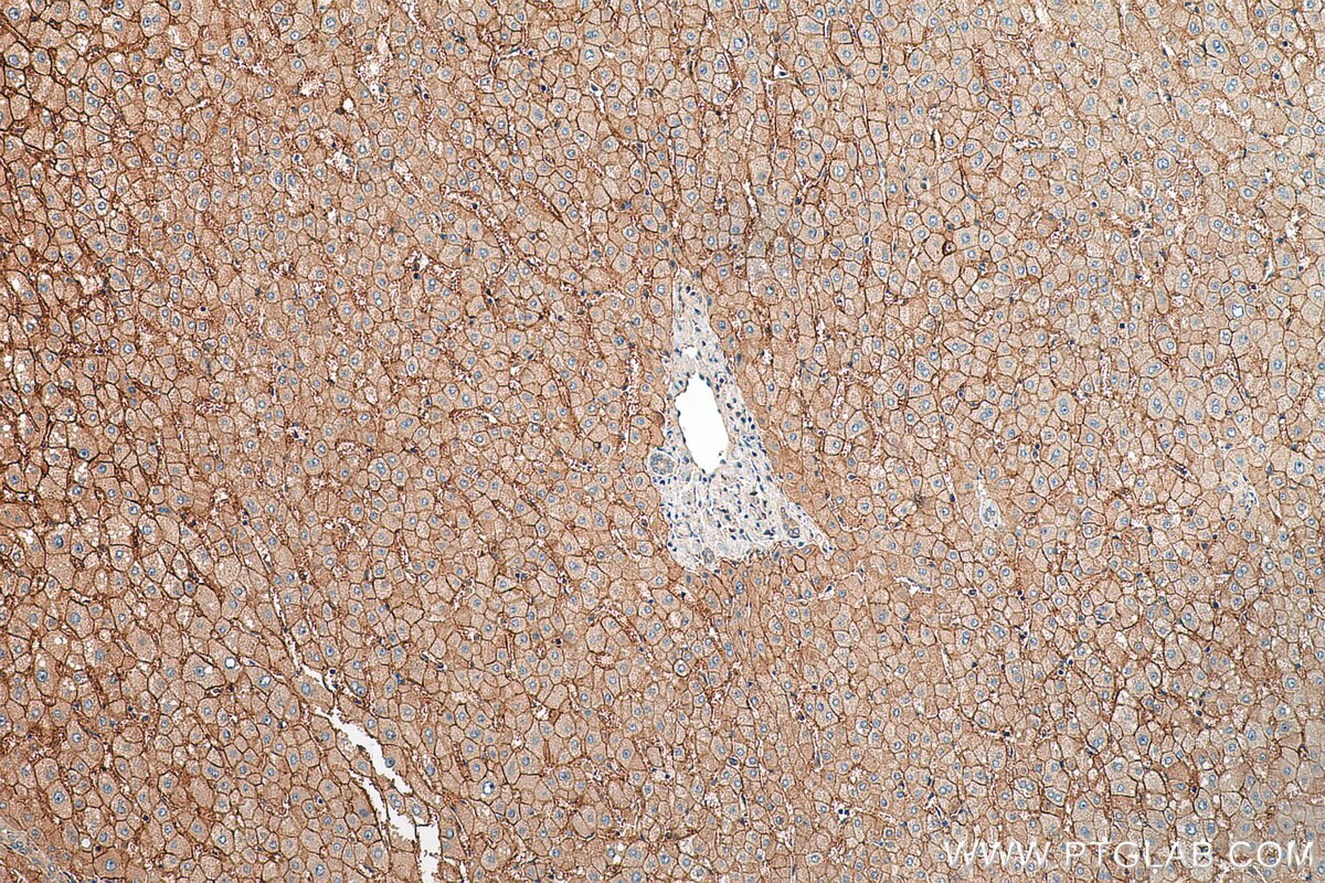 Immunohistochemistry (IHC) staining of human liver tissue using AQP9 Polyclonal antibody (20380-1-AP)