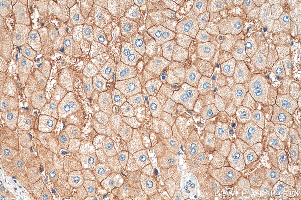 Immunohistochemistry (IHC) staining of human liver tissue using AQP9 Polyclonal antibody (20380-1-AP)