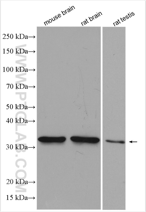 Western Blot (WB) analysis of various lysates using AQP9 Polyclonal antibody (20380-1-AP)