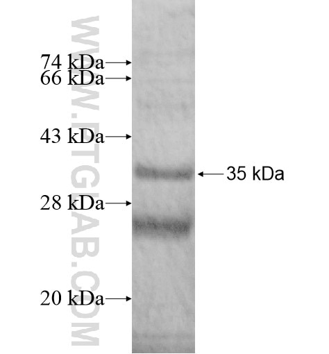 AQP9 fusion protein Ag14200 SDS-PAGE