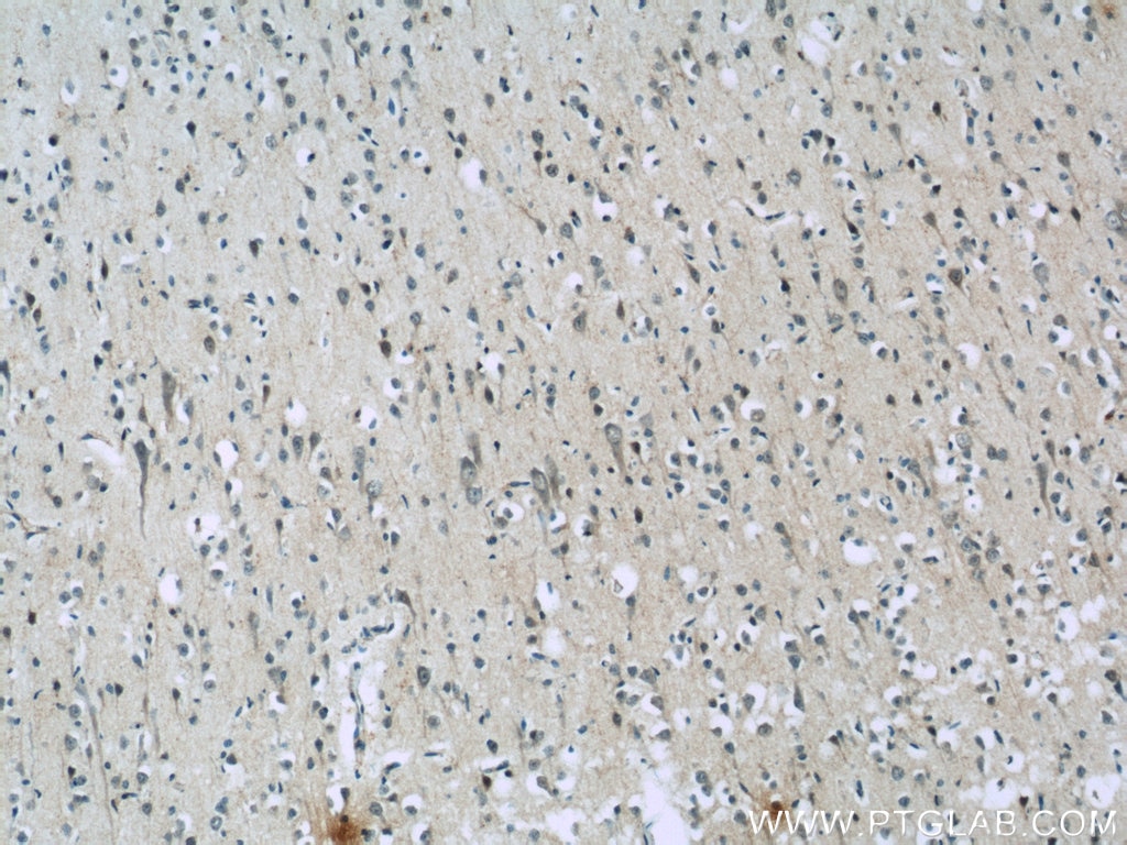 Immunohistochemistry (IHC) staining of human brain tissue using AQR Polyclonal antibody (24342-1-AP)