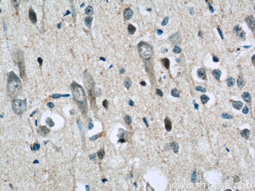 Immunohistochemistry (IHC) staining of human brain tissue using AQR Polyclonal antibody (24342-1-AP)