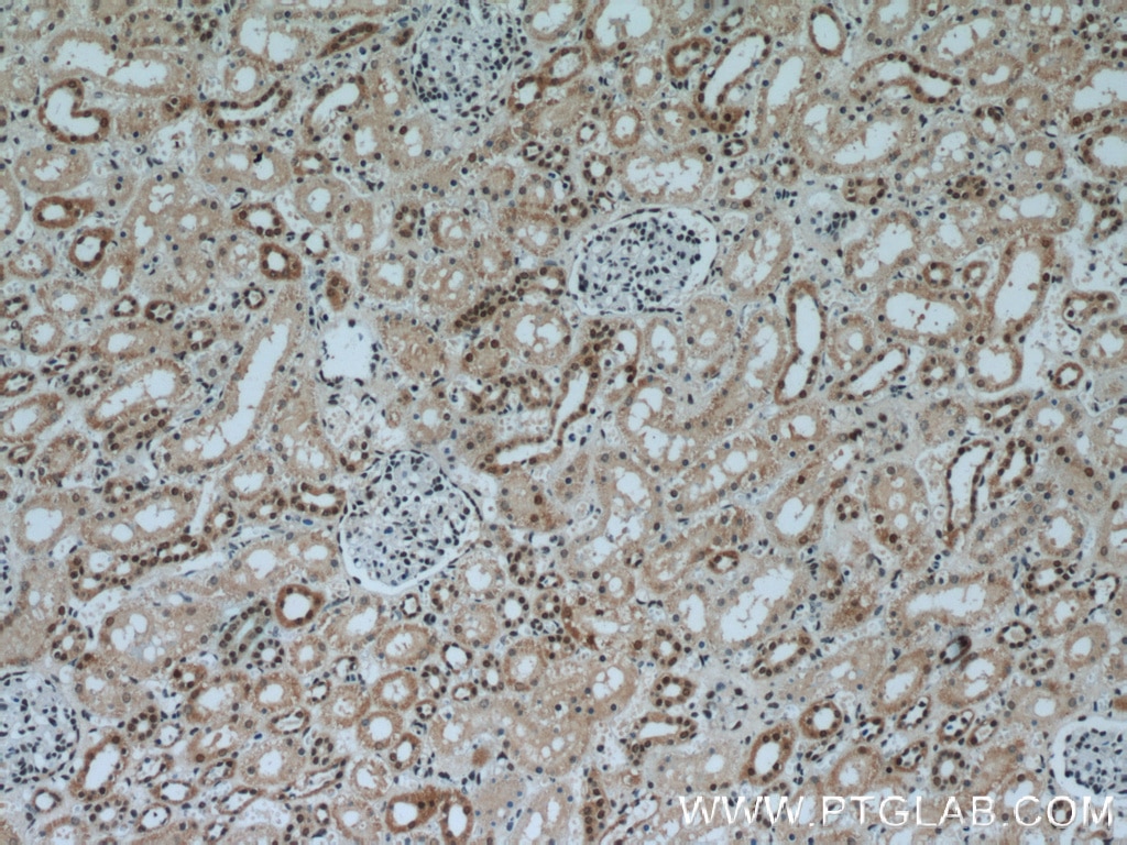 Immunohistochemistry (IHC) staining of human kidney tissue using AQR Polyclonal antibody (24342-1-AP)