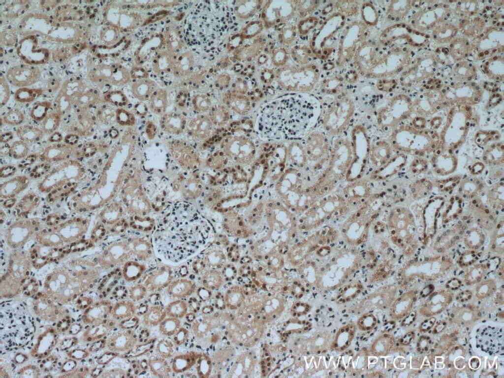 IHC staining of human kidney using 24342-1-AP