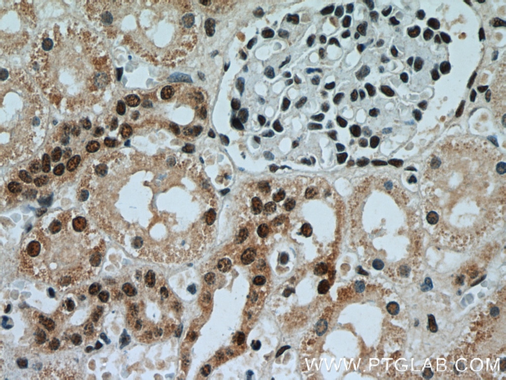 Immunohistochemistry (IHC) staining of human kidney tissue using AQR Polyclonal antibody (24342-1-AP)