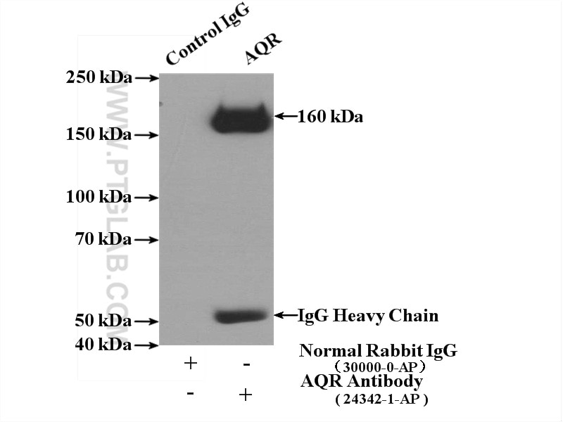 Immunoprecipitation (IP) experiment of HEK-293 cells using AQR Polyclonal antibody (24342-1-AP)
