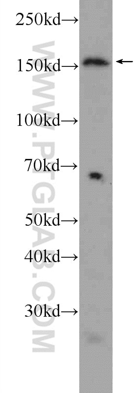 Western Blot (WB) analysis of HEK-293 cells using AQR Polyclonal antibody (24342-1-AP)