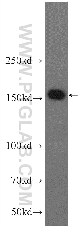 Western Blot (WB) analysis of HEK-293 cells using AQR Polyclonal antibody (24342-1-AP)