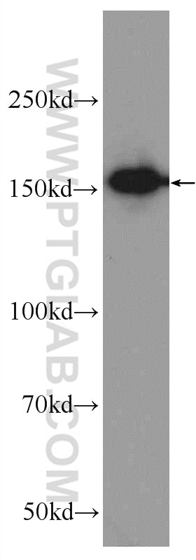 Western Blot (WB) analysis of Jurkat cells using AQR Polyclonal antibody (24342-1-AP)