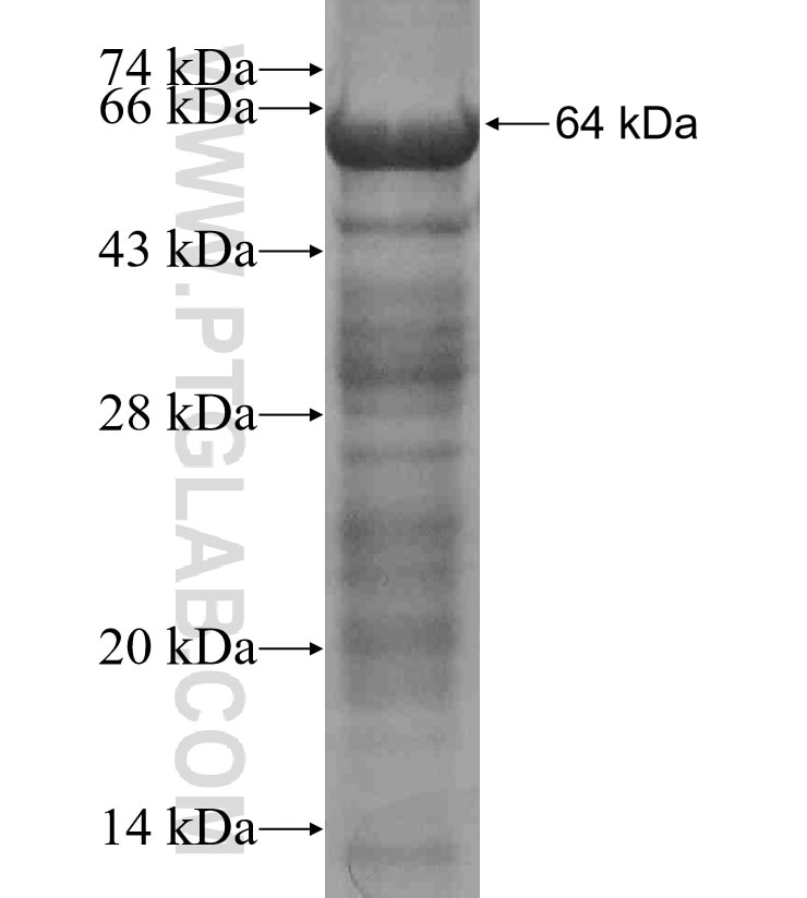 AQR fusion protein Ag17810 SDS-PAGE