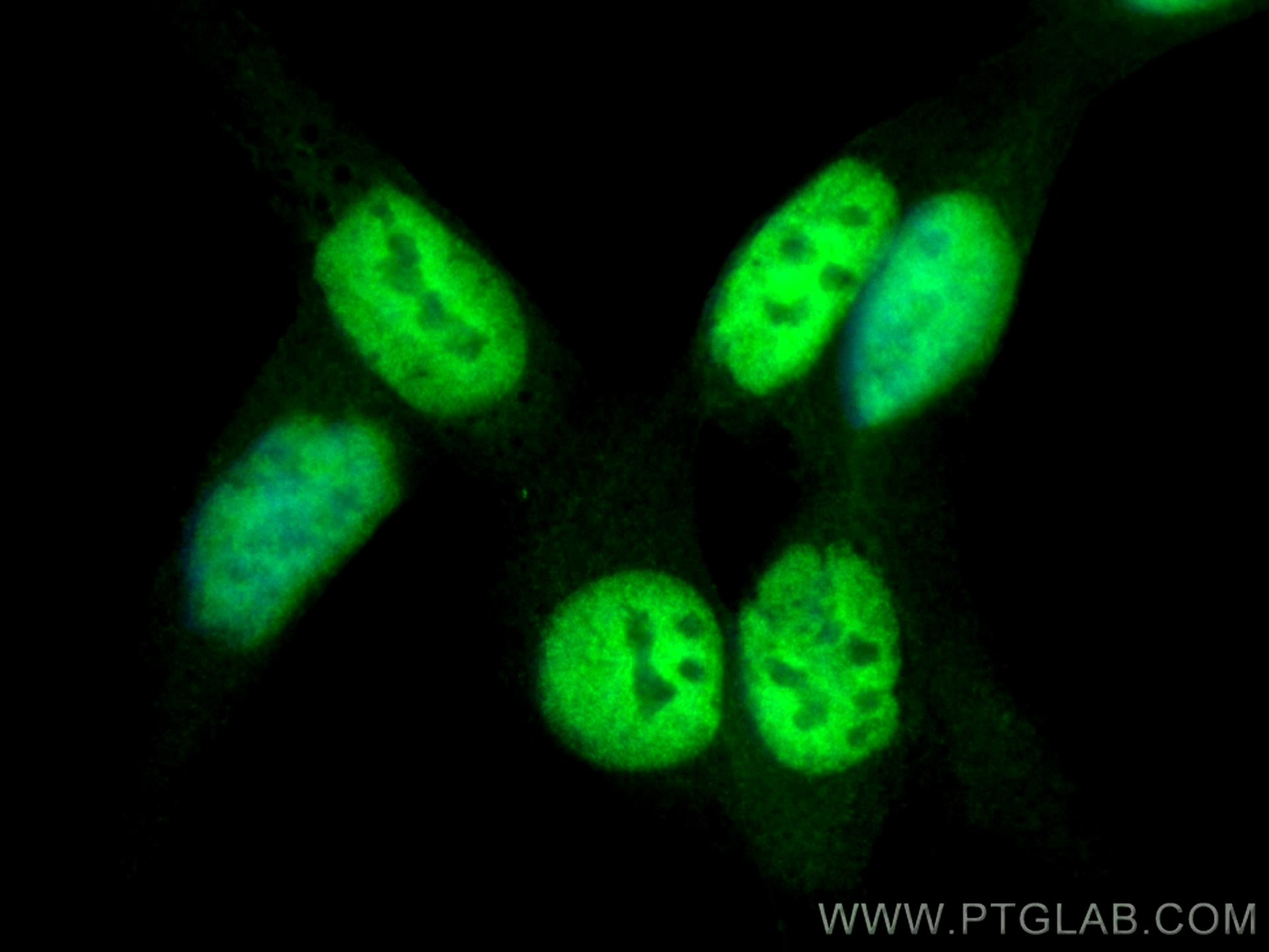 IF Staining of LNCaP using 22089-1-AP