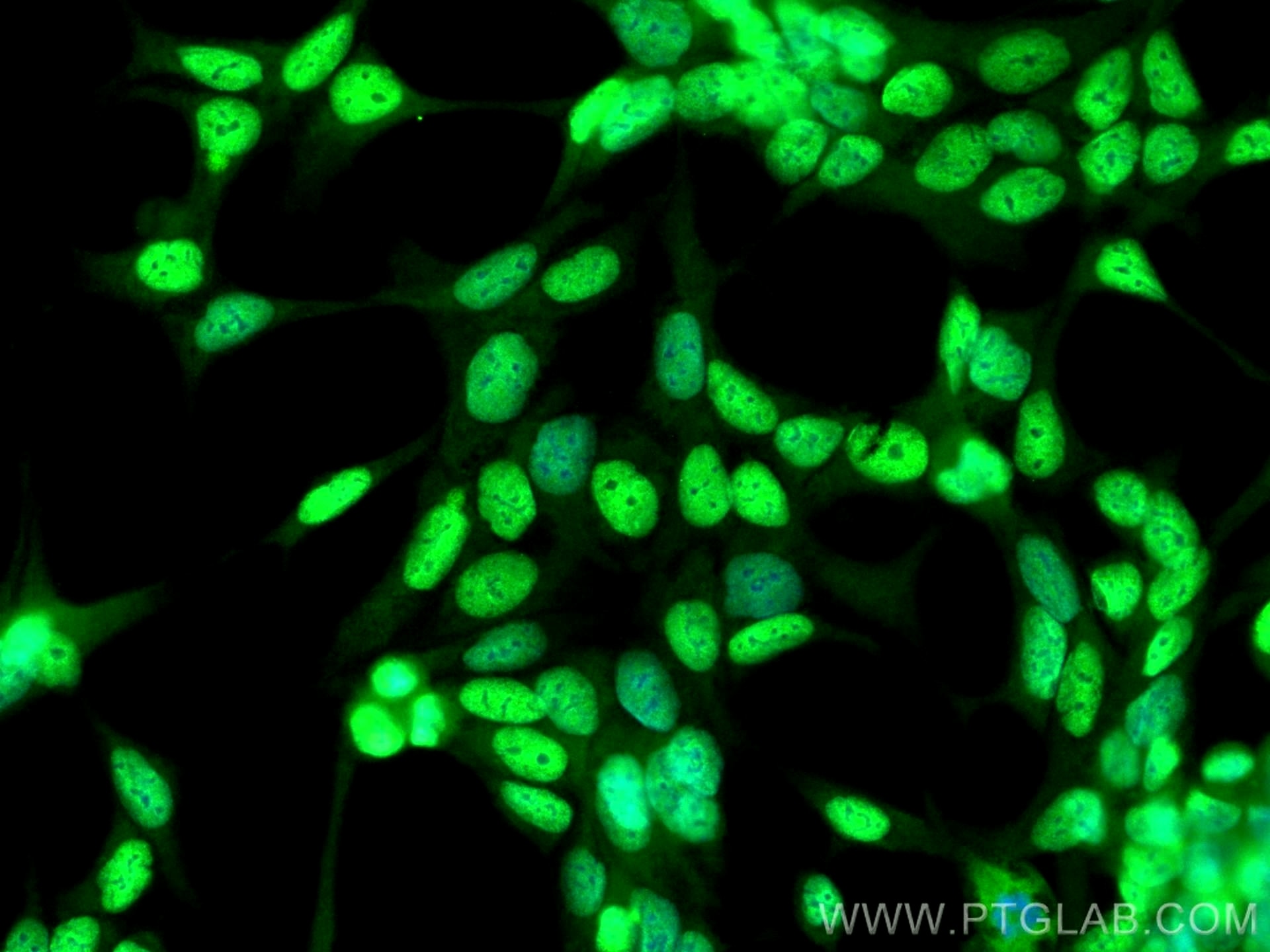Immunofluorescence (IF) / fluorescent staining of LNCaP cells using androgen receptor Polyclonal antibody (22089-1-AP)