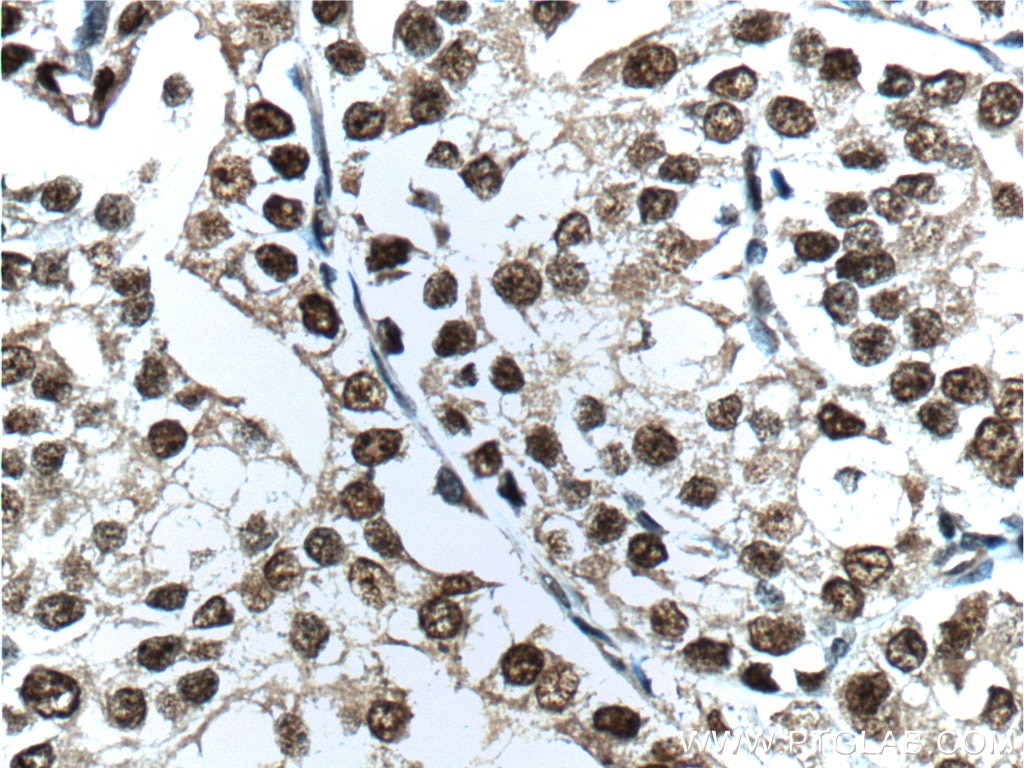 androgen receptor Polyclonal antibody