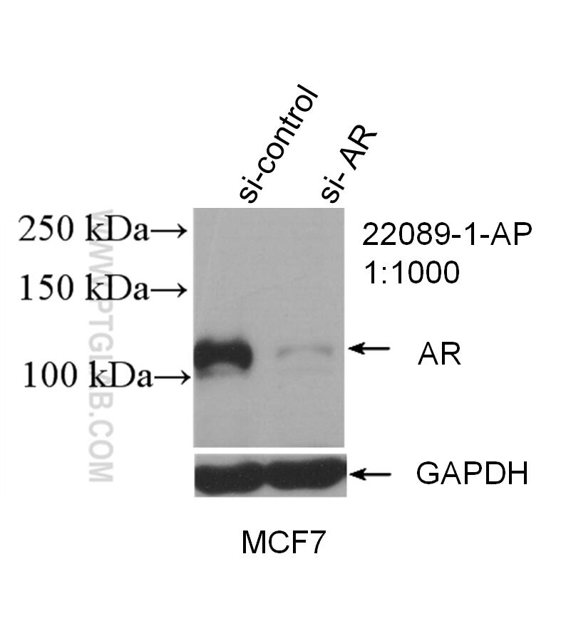 Western Blot (WB) analysis of MCF-7 cells using androgen receptor Polyclonal antibody (22089-1-AP)