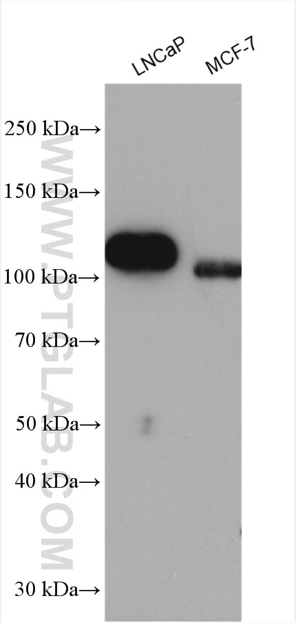 Western Blot (WB) analysis of various lysates using androgen receptor Polyclonal antibody (22089-1-AP)