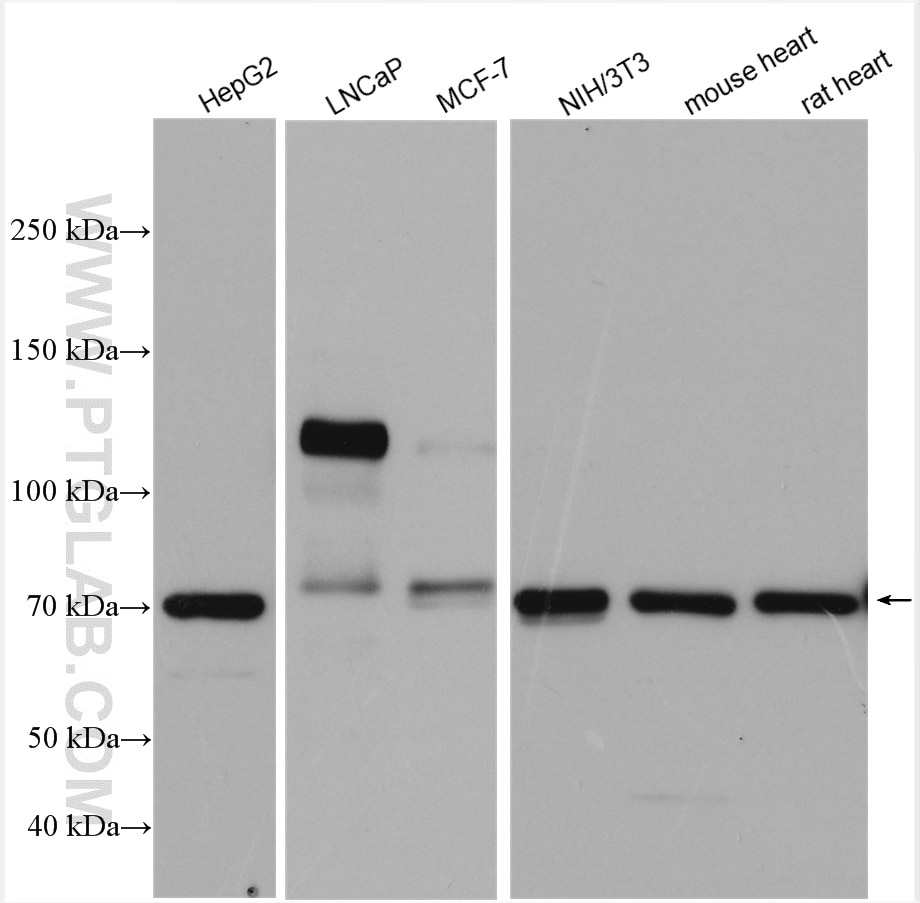 Western Blot (WB) analysis of various lysates using androgen receptor Polyclonal antibody (22089-1-AP)