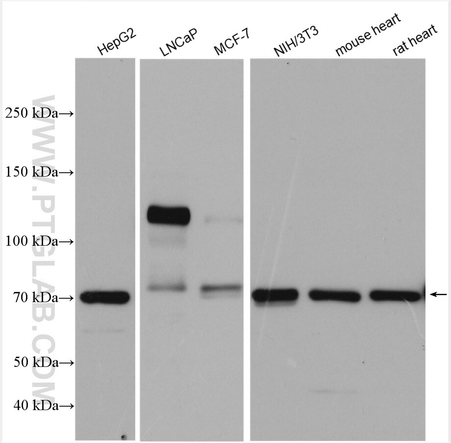 Western Blot (WB) analysis of various lysates using androgen receptor Polyclonal antibody (22089-1-AP)