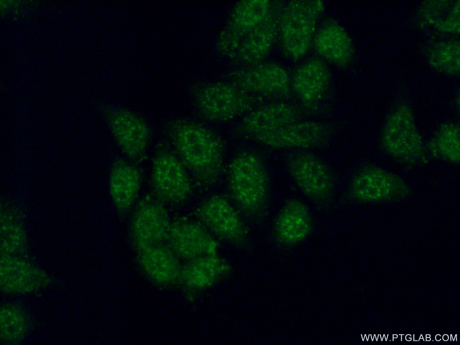 androgen receptor Polyclonal antibody