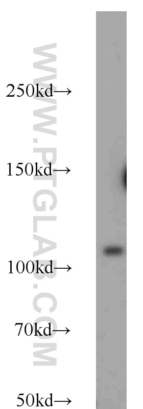 androgen receptor Polyclonal antibody