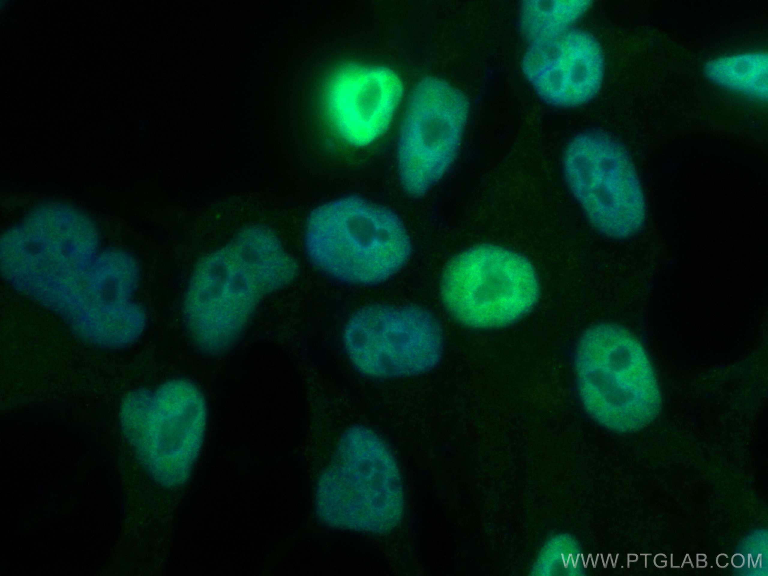 Immunofluorescence (IF) / fluorescent staining of LNCaP cells using androgen receptor Monoclonal antibody (66747-1-Ig)