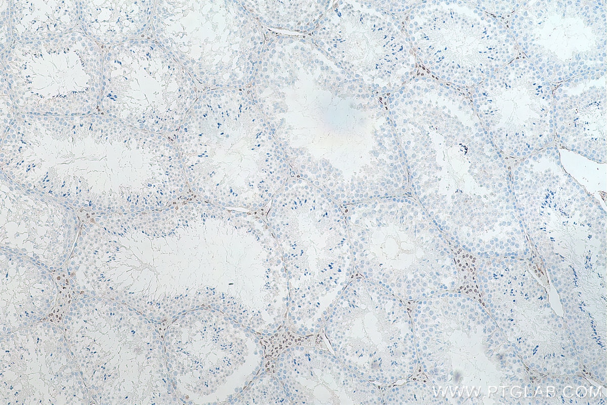 Immunohistochemistry (IHC) staining of mouse testis tissue using androgen receptor Monoclonal antibody (66747-1-Ig)