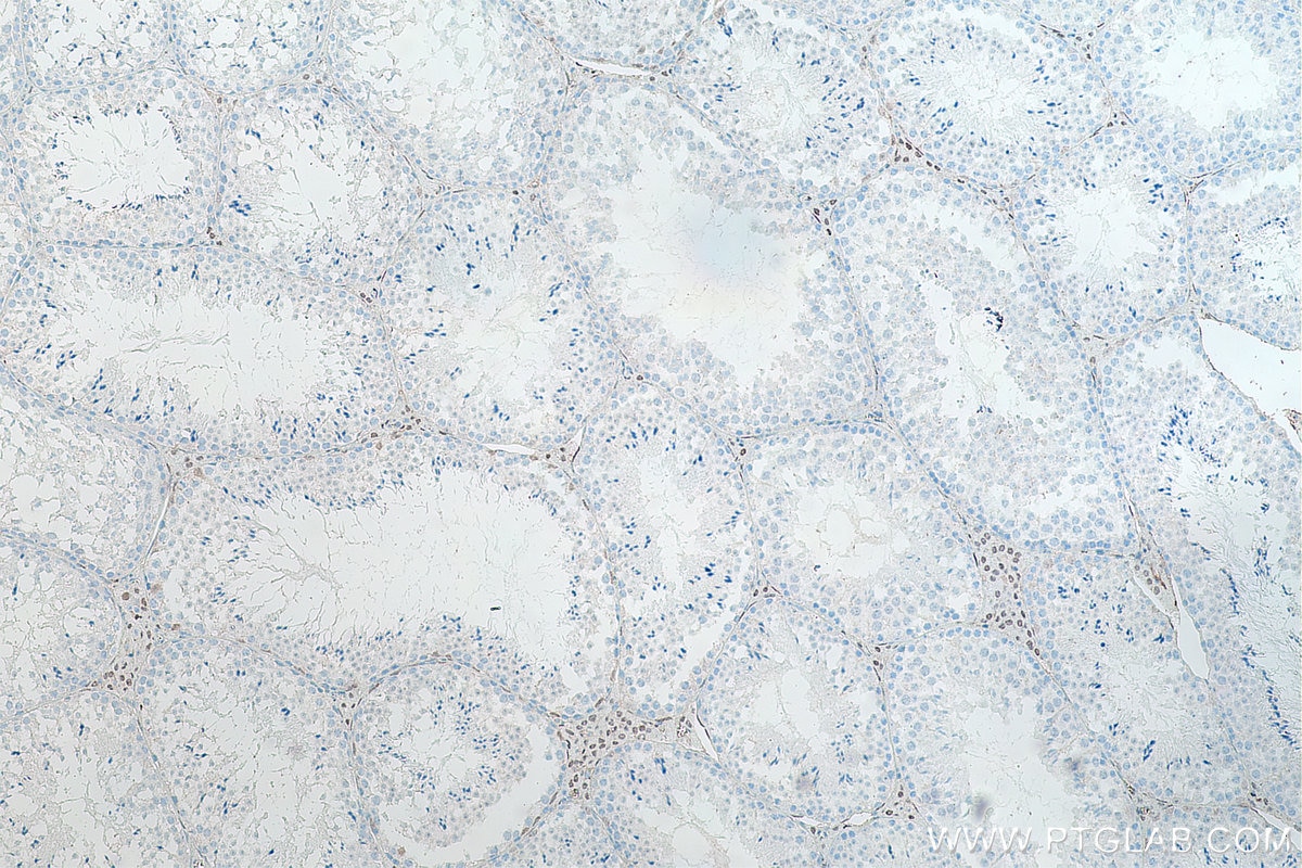 IHC staining of mouse testis using 66747-1-Ig