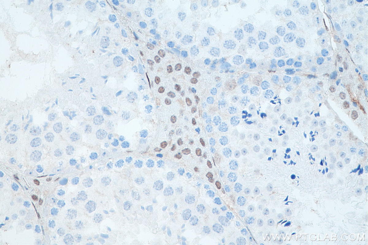 Immunohistochemistry (IHC) staining of mouse testis tissue using androgen receptor Monoclonal antibody (66747-1-Ig)
