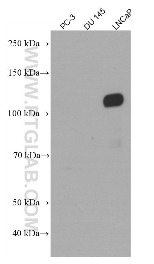 Western Blot (WB) analysis of various lysates using androgen receptor Monoclonal antibody (66747-1-Ig)