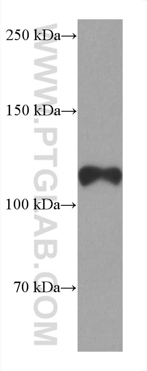 Western Blot (WB) analysis of human testis tissue using androgen receptor Monoclonal antibody (66747-1-Ig)