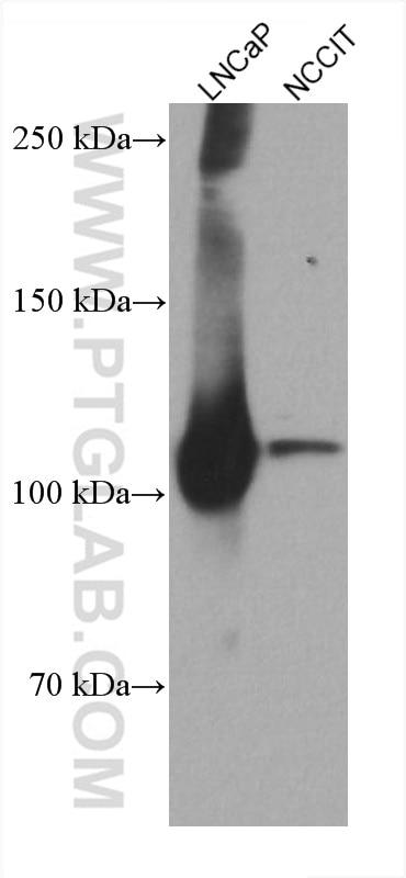 Western Blot (WB) analysis of various lysates using androgen receptor Monoclonal antibody (66747-1-Ig)