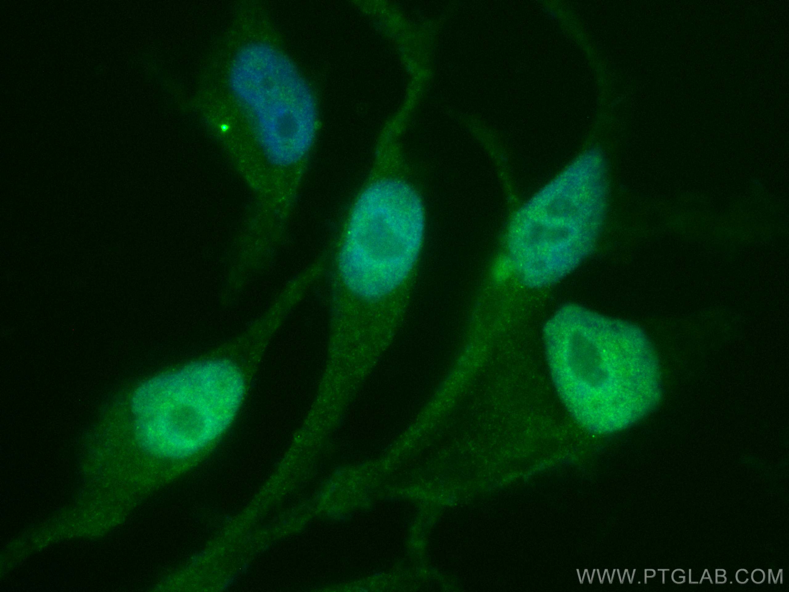 Immunofluorescence (IF) / fluorescent staining of LNCaP cells using CoraLite® Plus 488-conjugated AR Monoclonal antibo (CL488-66747)