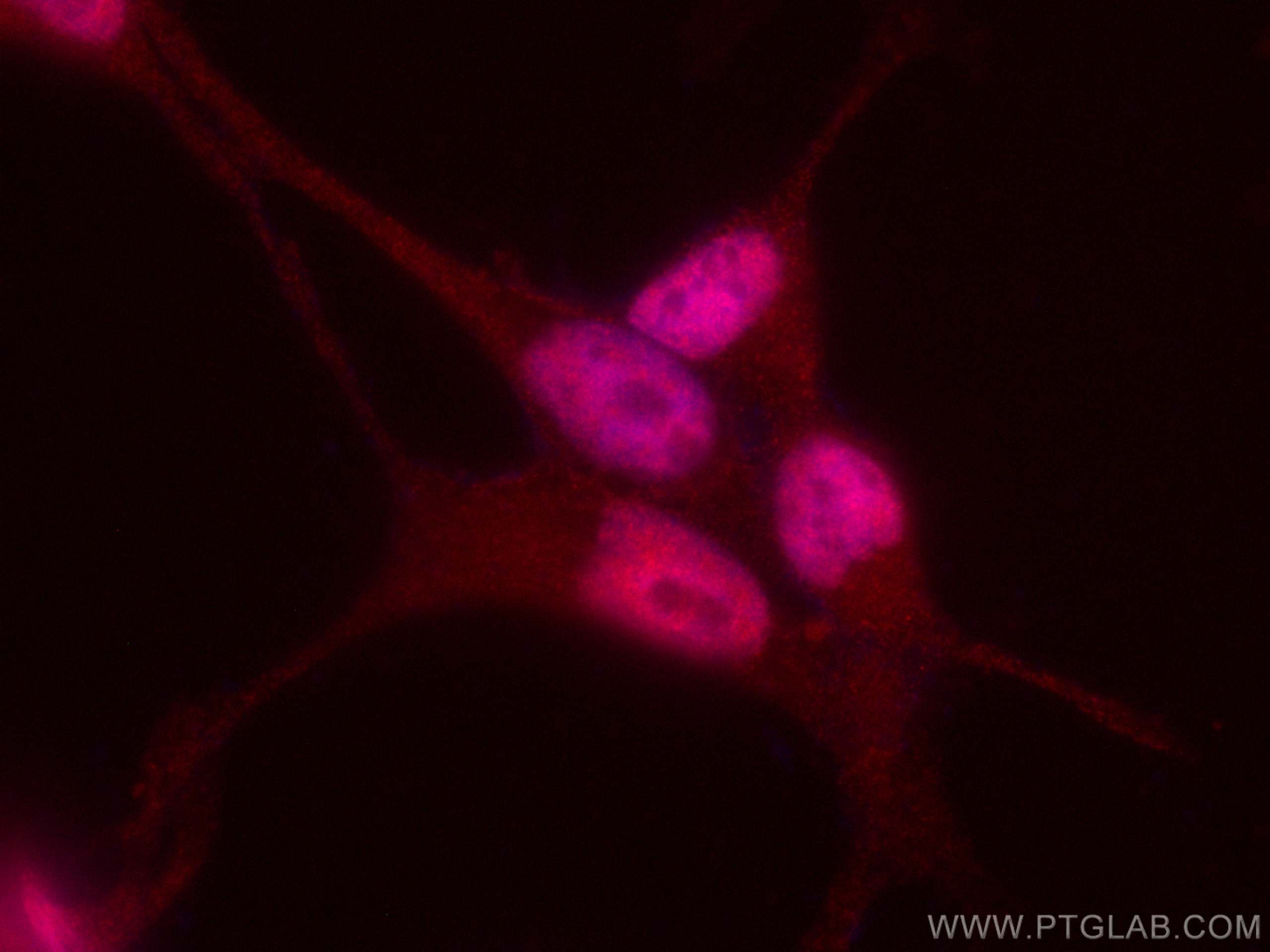 Immunofluorescence (IF) / fluorescent staining of LNCaP cells using CoraLite®594-conjugated AR Monoclonal antibody (CL594-66747)