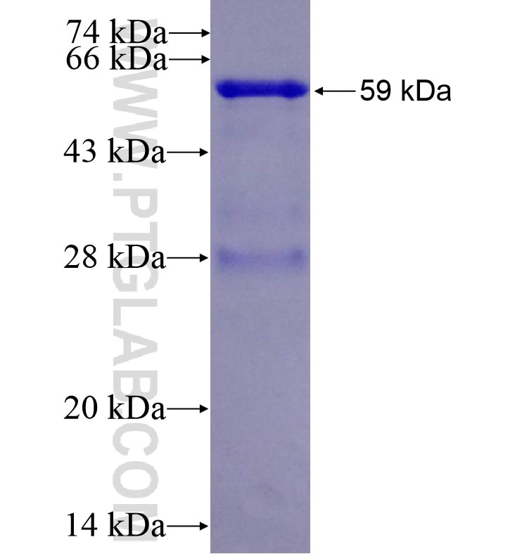 AR fusion protein Ag16449 SDS-PAGE